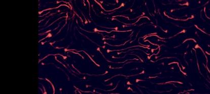 Enterobacter bloom